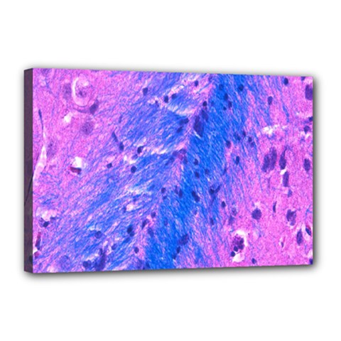 The Luxol Fast Blue Myelin Stain Canvas 18  X 12  by Mariart