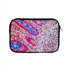 Histology Inc Histo Logistics Incorporated Alcian Blue Apple Macbook Pro 15  Zipper Case by Mariart