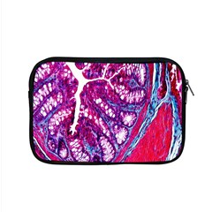 Histology Inc Histo Logistics Incorporated Masson s Trichrome Three Colour Staining Apple Macbook Pro 15  Zipper Case by Mariart